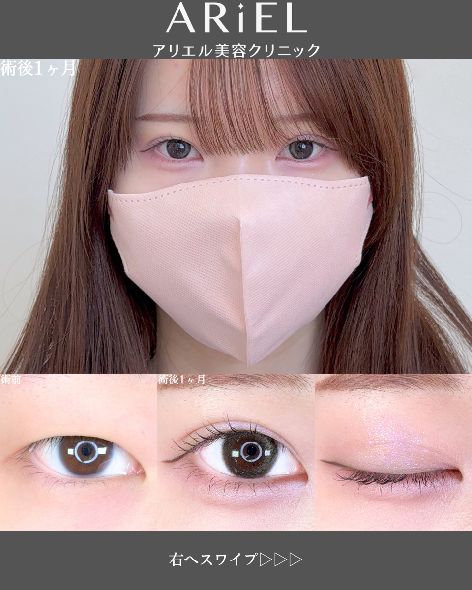 No.8903の症例写真